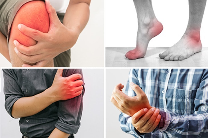 Bệnh viêm khớp thường gặp ở khớp gối, bàn tay, bàn chân, bả vai, cột sống 