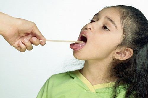 Tìm hiểu: Nguyên nhân gây hôi miệng ở trẻ