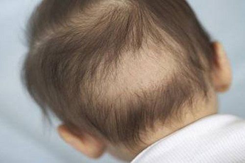 Tìm hiểu: Nguyên nhân gây rụng tóc ở trẻ nhỏ và cách xử lý