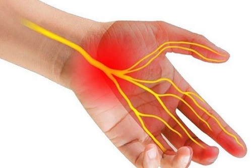 Những điều bạn cần biết về bệnh viêm khớp cổ tay